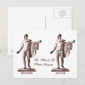 Vor und nach postkarte (Vorne/Hinten)