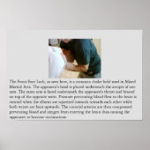 Vordere Feststelltaste oder Vorderschloss Poster (Vorne)