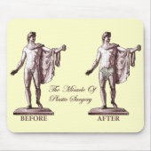 Vorher und nachher mousepad (Vorne)