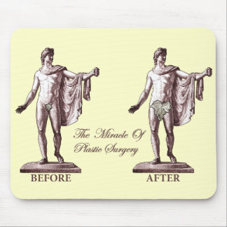 Vorher und nachher mousepad