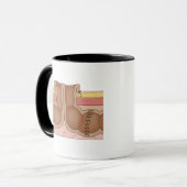 Vorübergehender Colostomy Tasse (Vorderseite Links)