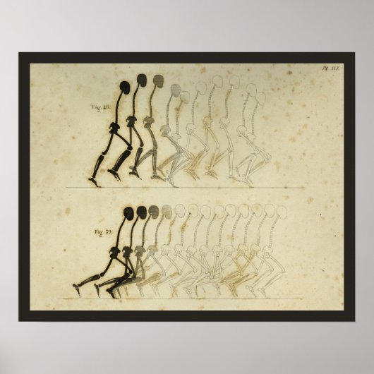 Wanderung Gait Analysis Leg Spine Chiropractic Cha Poster (Vorne)