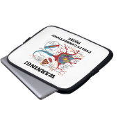Warnung! Fehlerhafte Verbindungen innerhalb der Laptopschutzhülle (Vorne Knopf)