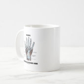 Warnung! Karpaltunnelsyndrom Inside (Anatomie) Kaffeetasse (Vorderseite Links)