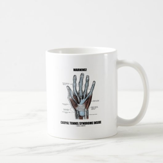 Warnung! Karpaltunnelsyndrom Inside (Anatomie) Kaffeetasse (Rechts)