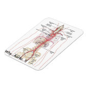 WARUM... Aorta..! Aortenanatomie Magnet (Linke Seite)