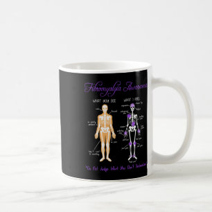 Was Sie sehen, was ich fühle Skeletton Fibromyalgi Kaffeetasse