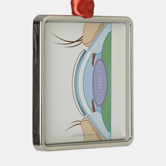 Weiche Kontaktlinse Ornament Aus Metall (Rechts)