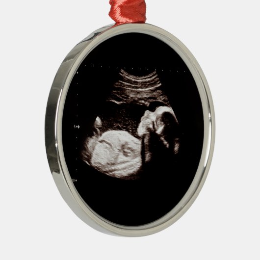 Weihnachtsschwangerschaft für Kleinkinder Ultrasou Ornament Aus Metall (Rechts)