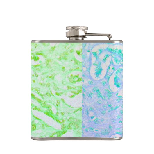 welche Mutter braucht Flachmann (Rückseite)