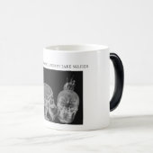 Wenn Radiologeen selfies nehmen Verwandlungstasse (VorderseiteRechts)