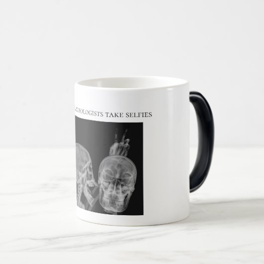 Wenn Radiologeen selfies nehmen Verwandlungstasse (VorderseiteRechts)