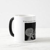 Wenn Radiologeen selfies nehmen Verwandlungstasse (Vorderseite Links)