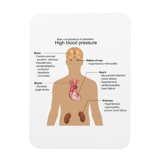 Wichtigste Komplikationen der Hochblutdruckdiagram Magnet (Vertikal)