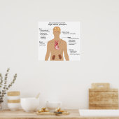 Wichtigste Komplikationen der Hochblutdruckdiagram Poster (Küche)