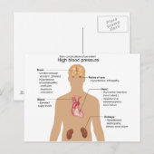 Wichtigste Komplikationen der Hochblutdruckdiagram Postkarte (Vorne/Hinten)