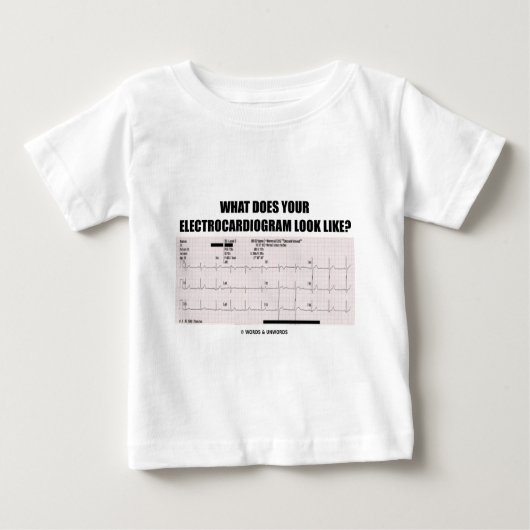 Wie was sieht Ihr Elektrokardiogramm aus? Baby T-shirt (Vorderseite)