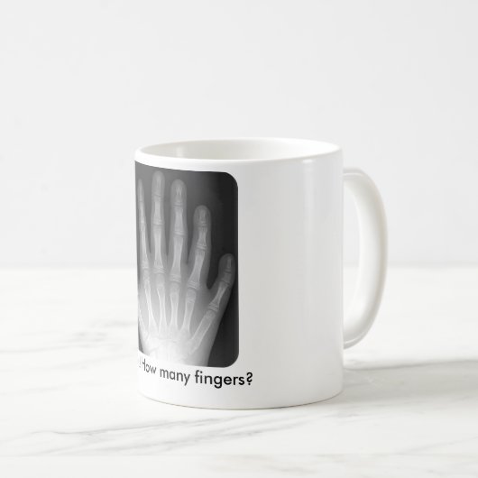 Wieviele Finger? Röntgenstrahl Kaffeetasse (VorderseiteRechts)
