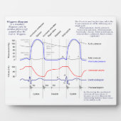 Wiggers-Diagramm Fotoplatte (Vorderseite)