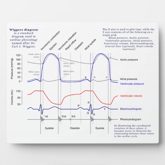 Wiggers-Diagramm Fotoplatte (Vorderseite)