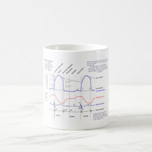 Wiggers Diagramm Kaffeetasse