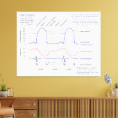 Wiggers-Diagramm Leinwanddruck (Insitu (Wohnzimmer))