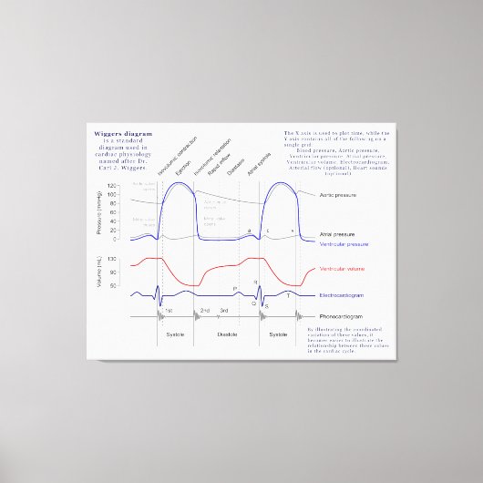 Wiggers-Diagramm Leinwanddruck (Vorderseite)