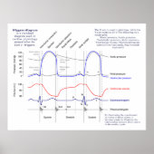 Wiggers-Diagramm Poster (Vorne)