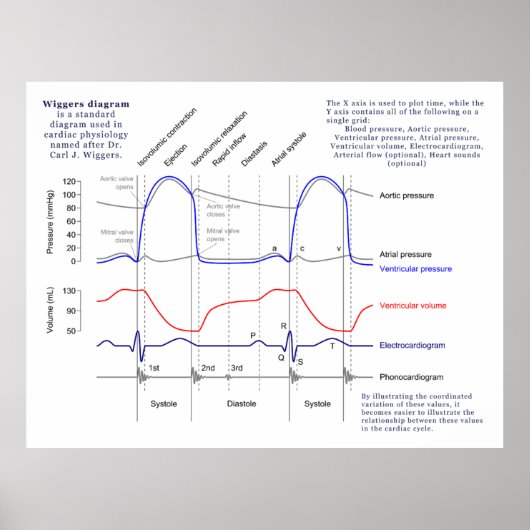 Wiggers-Diagramm Poster (Vorne)