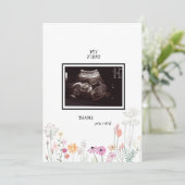 Wildblumen Ultrasound Foto Danke Funny (Stehend Vorderseite)