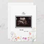 Wildblumen Ultrasound Foto Danke Funny (Vorne/Hinten)