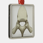 Wirbel Ornament Aus Metall (Rechts)