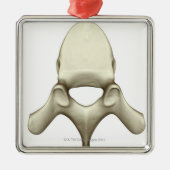 Wirbel Ornament Aus Metall (Vorne)