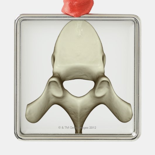 Wirbel Ornament Aus Metall (Vorne)