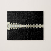 Wirbelsäule 2 puzzle (Horizontal)