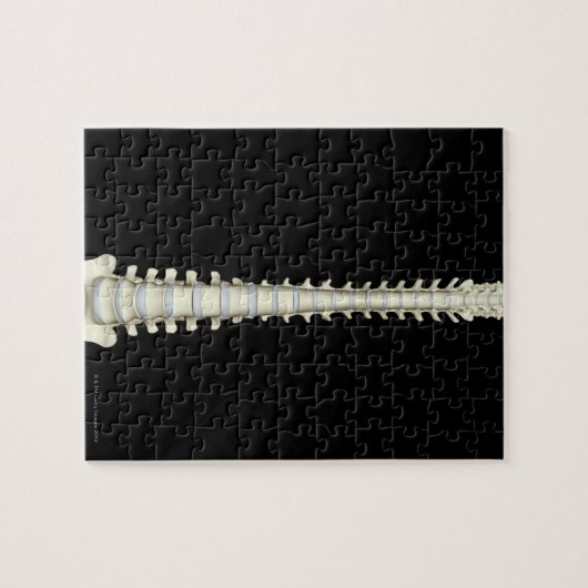 Wirbelsäule 2 puzzle (Horizontal)