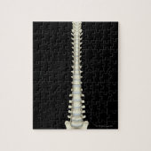 Wirbelsäule 2 puzzle (Vertikal)