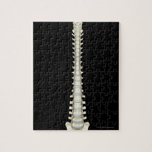 Wirbelsäule 2 puzzle (Vertikal)