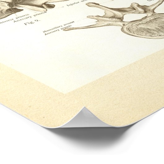 Wirbelsäule und Wirbelsäule-Anatomie-Poster Poster (Ecke)