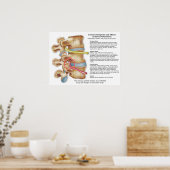 Wirkungen der Spinalsubluxation Chiropraktisches P Poster (Küche)