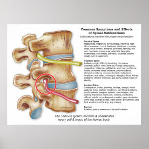 Wirkungen der Spinalsubluxation Chiropraktisches P Poster