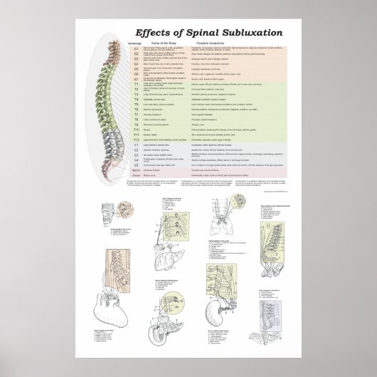 Wirkungen des Spinal Subluxation Poster Chiroprakt (Vorne)