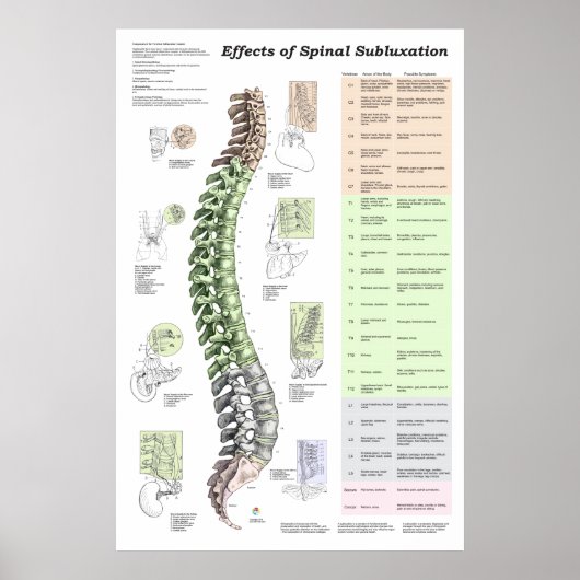 Wirkungen des Spinal Subluxation Poster Chiroprakt (Vorne)