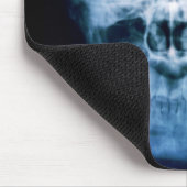 X-Köpfig Mousepad (Ecke)