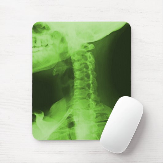 X-Rad 2 - Radioactive Green Mousepad (Mit Mouse)