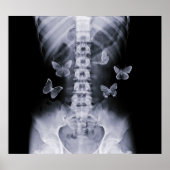 X-Ray Anticipatory Conceptual Butterflies Poster (Vorne)