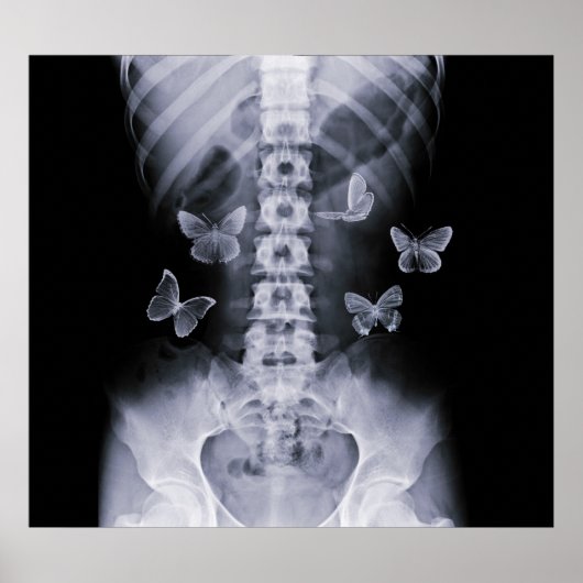 X-Ray Anticipatory Conceptual Butterflies Poster (Vorne)