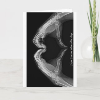 X-Ray Art Karte