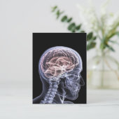 X-Ray Brain Postkarte (Stehend Vorderseite)