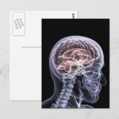 X-Ray Brain Postkarte (Vorne/Hinten)